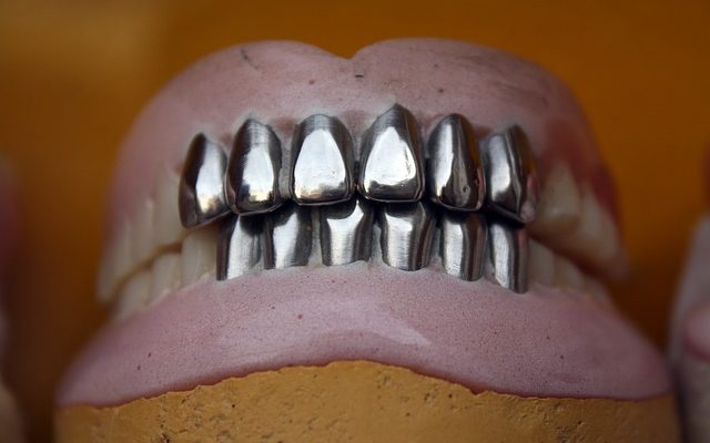 Comment enlever les taches des prothèses dentaires et des fausses dents.