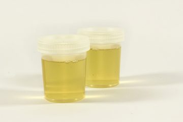 Odeur normale de l'urine