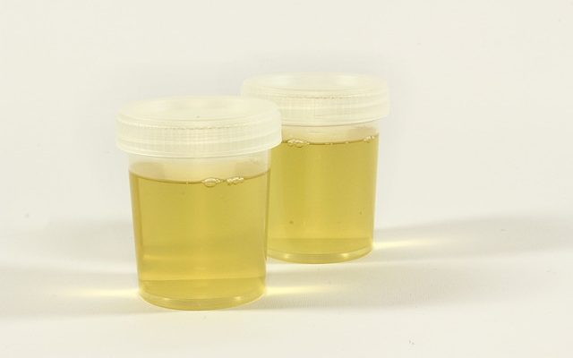 Odeur normale de l'urine