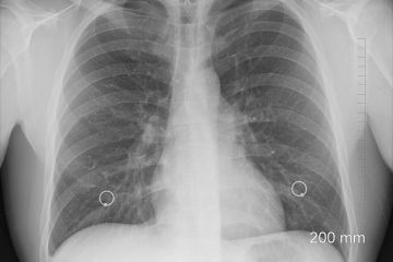 Les avantages de la radiographie