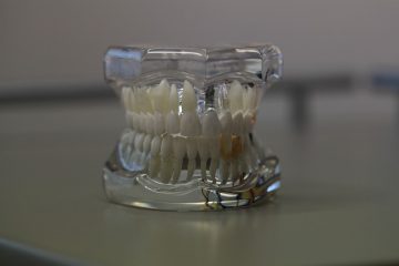 Que puis-je utiliser pour coller une dent sur une prothèse dentaire ?