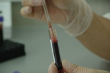 Qu'est-ce qu'un test sanguin au plasma ?
