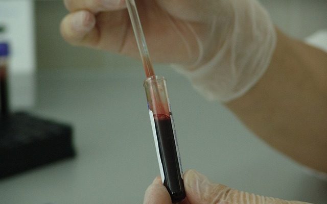 Qu'est-ce qu'un test sanguin au plasma ?