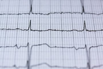 Qu'est-ce qu'un taux normal de tension artérielle ?