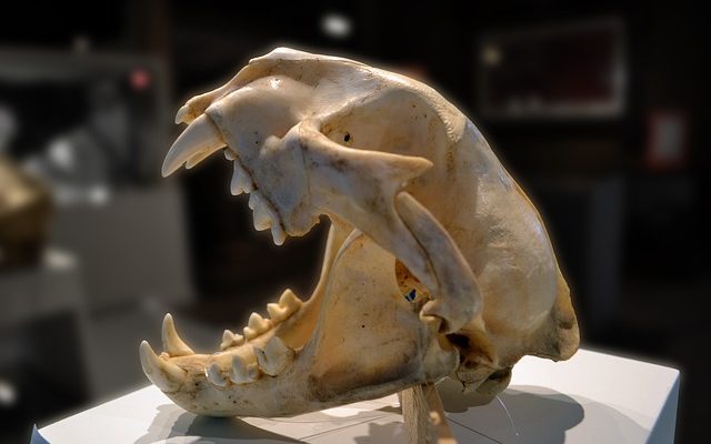 La meilleure façon de se débarrasser du tartre sur les dents.