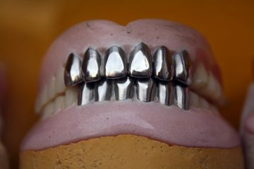 Comment apaiser les gencives après le port d'un dentier